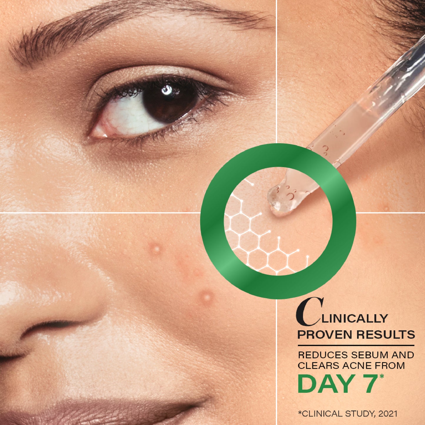 Novology Acne Clearing Serum