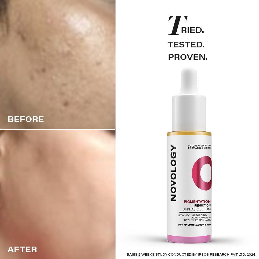 Novology Bi-Phasic Hyper Pigmentation Serum
